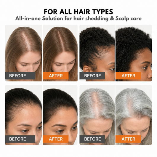 Korean Hair Growth Serum for Thinning Hair & Shedding
