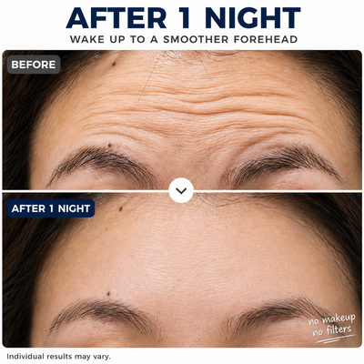 Instant Wrinkle-Smoothing Forehead Patch