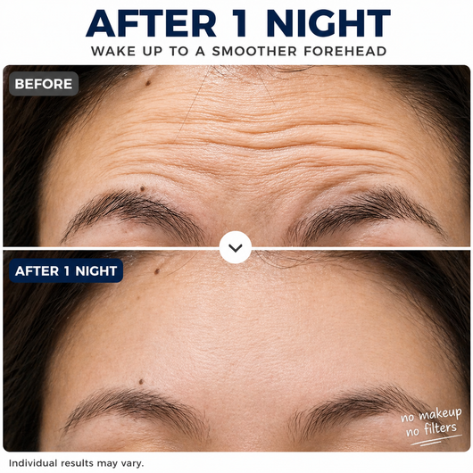 Instant Wrinkle-Smoothing Forehead Patch
